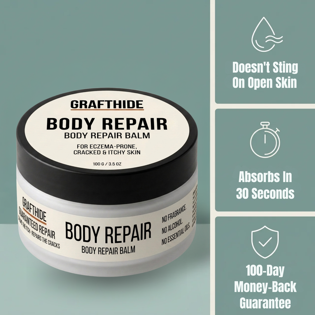 GRAFTHIDE ECZEMA &amp; DRY SKIN REPAIR BALM